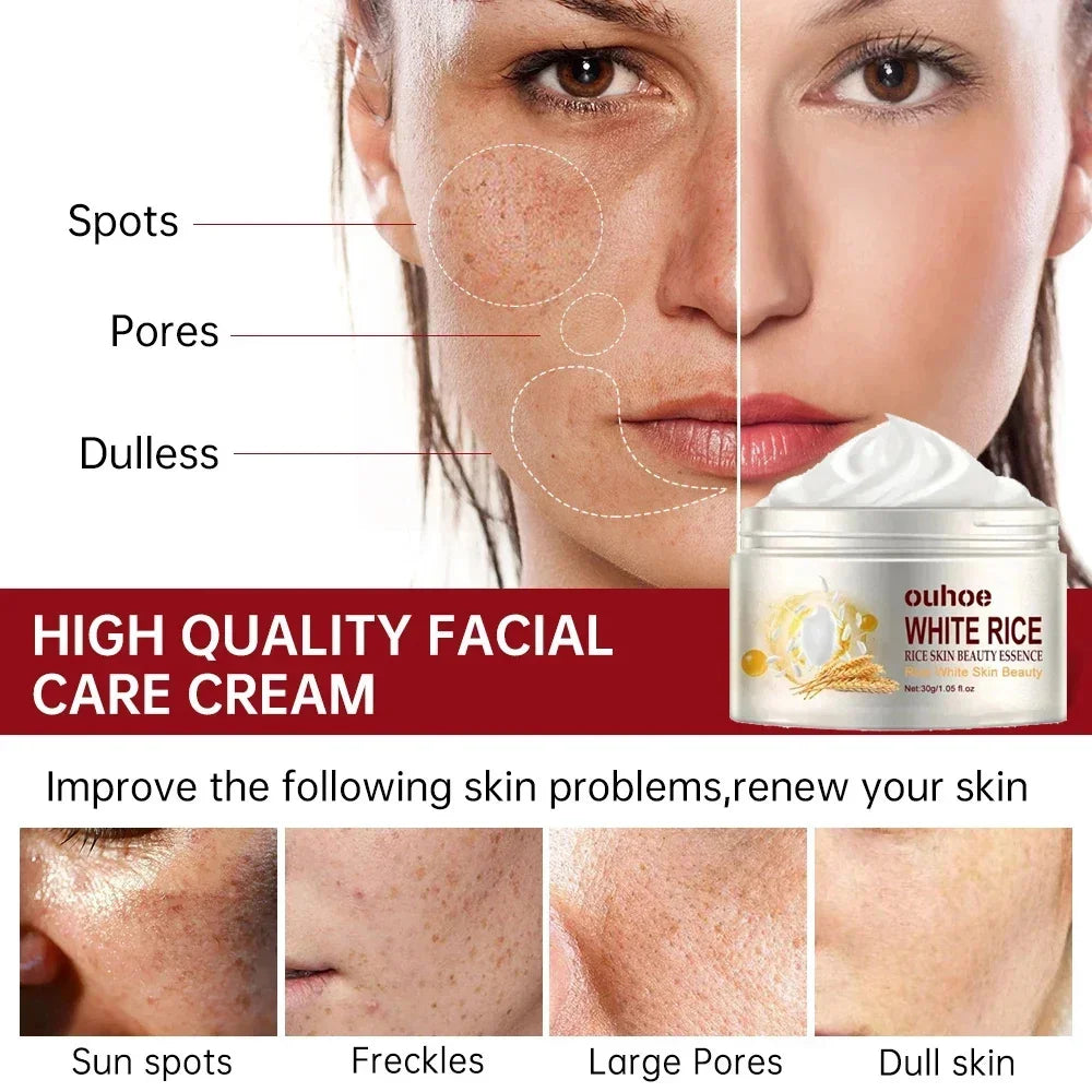 White Rice Whitening Face Cream – Anti-Aging, Dark Spot Remover & Brightening Moisturizer 30g