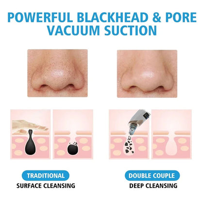 Electric Blackhead Remover Portable USB Facial Pore Cleaner