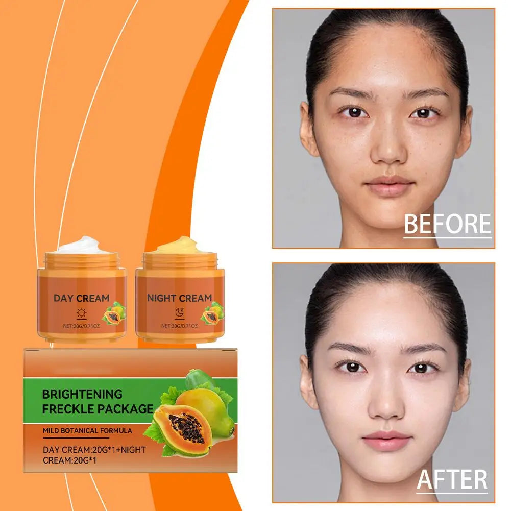 Papaya Whitening Cream Remove Freckle Lighten Dark Pigmentation