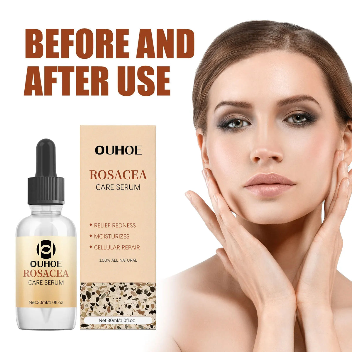 OUHOE Rosacea & Redness Relief Face Serum – Soothing & Repairing