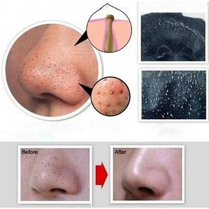 Blackhead Remover Mask Bamboo Charcoal Shrink Pores Acne Black