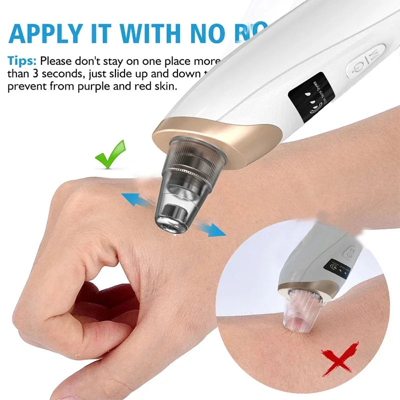 Electric Blackhead Remover Portable USB Facial Pore Cleaner