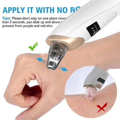 Electric Blackhead Remover Portable USB Facial Pore Cleaner