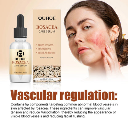 OUHOE Rosacea & Redness Relief Face Serum – Soothing & Repairing