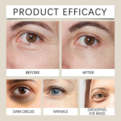 Firming Eye Roll-On with Essential Oil – Dark Circles, Wrinkles & Puffiness