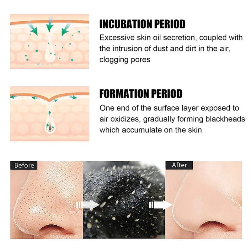 Blackhead Remover Mask Bamboo Charcoal Shrink Pores Acne Black