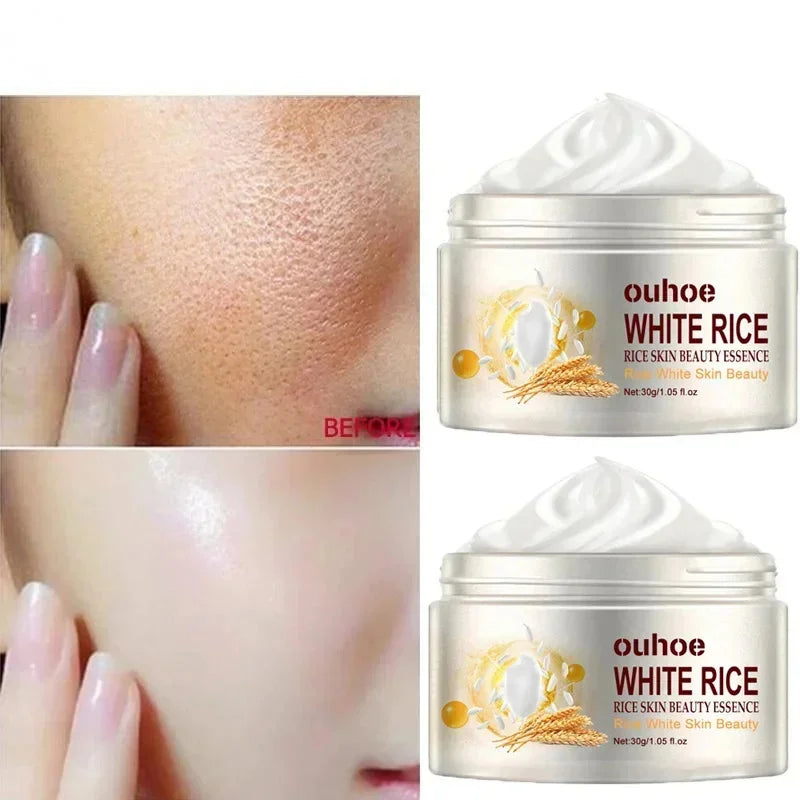 White Rice Whitening Face Cream – Anti-Aging, Dark Spot Remover & Brightening Moisturizer 30g