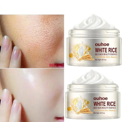White Rice Whitening Face Cream – Anti-Aging, Dark Spot Remover & Brightening Moisturizer 30g