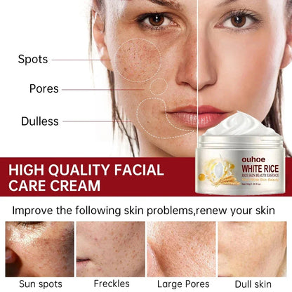White Rice Whitening Face Cream – Anti-Aging, Dark Spot Remover & Brightening Moisturizer 30g