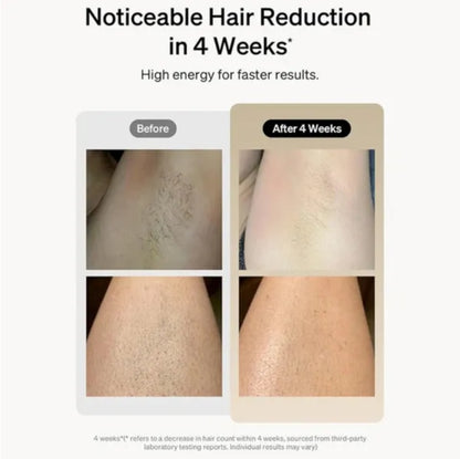 Professional Laser Epilator IPL Hair Removal Body Bikini